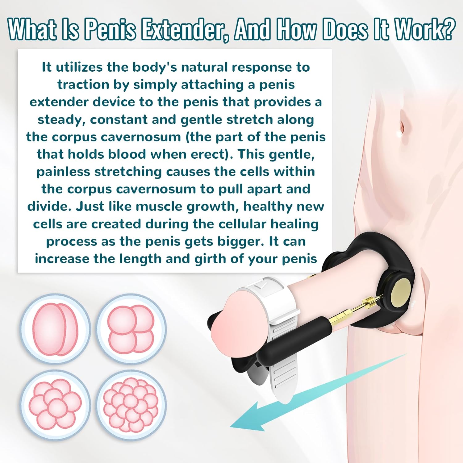 Yonglife – Penis Stretching
