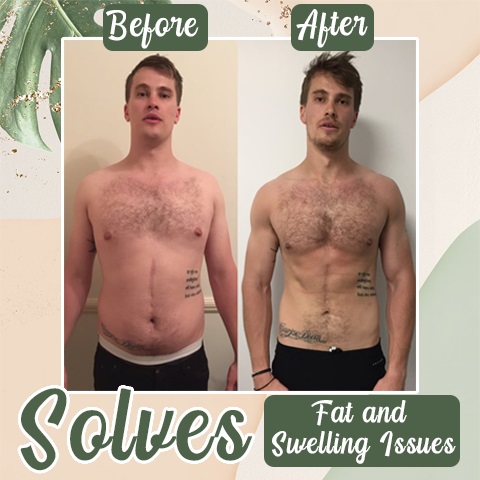 Perfect Detox Slimming Patch-suzhom