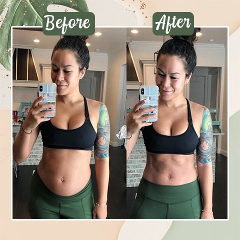 Perfect Detox Slimming Patch-suzhom