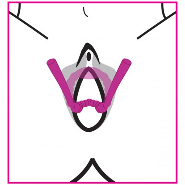 Frisky Petal Pusher Silicone Labia Spreader | UberKinky