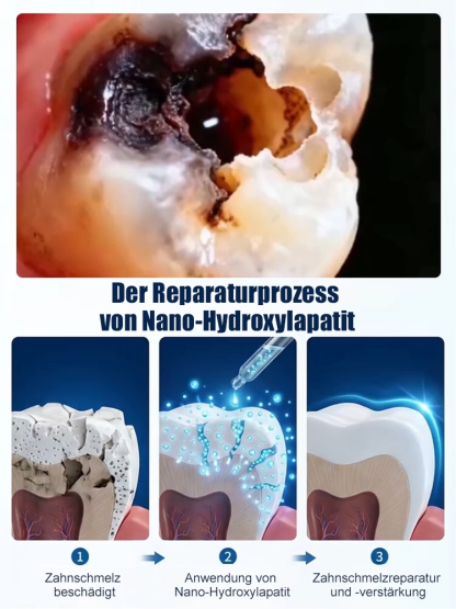 【Von renommierten Zahnärzten empfohlen】Hydroxylapatit-Zahnschutz-Tropfen