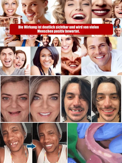 Bequemer Prothesen-Satz für optimale Gesichtsstütze, empfohlen von Experten