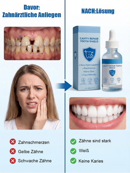 【Von renommierten Zahnärzten empfohlen】Hydroxylapatit-Zahnschutz-Tropfen