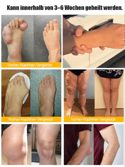 【Meilenstein der Sportmedizin】Atmungsaktives Pflaster zur Linderung von Gelenkschmerzen