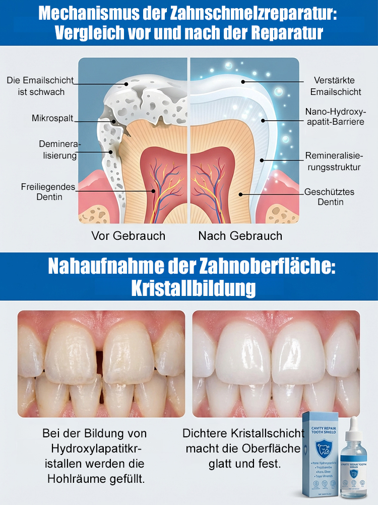 【Von renommierten Zahnärzten empfohlen】Hydroxylapatit-Zahnschutz-Tropfen