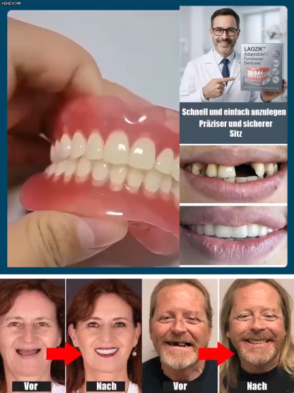 Bequemer Prothesen-Satz für optimale Gesichtsstütze, empfohlen von Experten