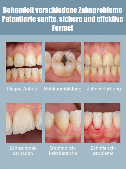 【Von renommierten Zahnärzten empfohlen】Hydroxylapatit-Zahnschutz-Tropfen