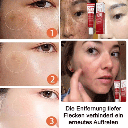 Aufhellende Anti-Flecken-Creme