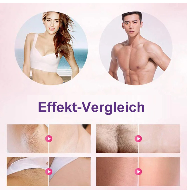 Empfohlen von der Aesthetic Society! ✨ [Unisex] Intelligentes, schmerzfreies Haarentfernungsgerät!