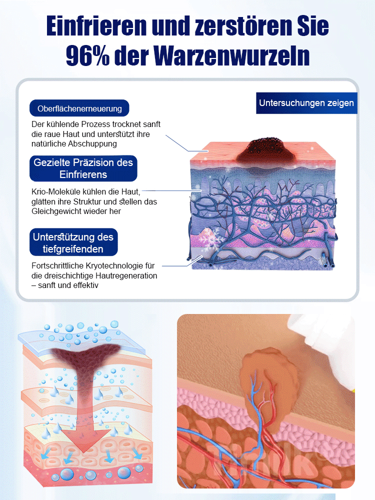 Makellose Haut war nie einfacher. 🧪 Unsere dermatologisch inspirierte Formel regeneriert Ihre Haut tiefenwirksam. 