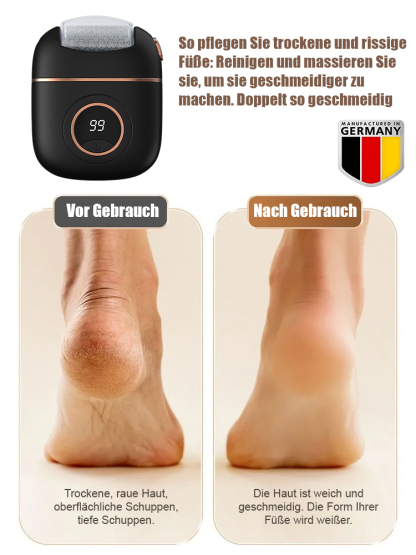 Neue digitale elektrische Fußpoliermaschine