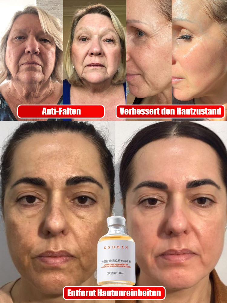  Schluss mit verschwendetem Geld für wasserbasierte Cremes, die nur auf der Hautoberfläche wirken! 🛑 Entdecken Sie die Active Collagen Essence der 3. Generation. Anders als herkömmliche Hautpflegeprodukte enthält unsere Formel 0 % Wasser – sie besteht zu