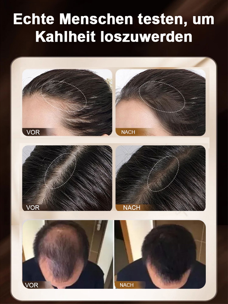 Immer noch Haarausfall? 【Expertenempfehlung】 Stellt die jugendliche Haarstruktur wieder her – für gesundes, volles Haar.