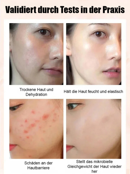 Freizeit-Snack Feigen mit Walnusskernen Trockenfrüchte 😘🥰Eine Delikatesse ohne einen einzigen Tropfen Zucker oder Öl! Reich an Ballaststoffen, Vitaminen und Antioxidantien.