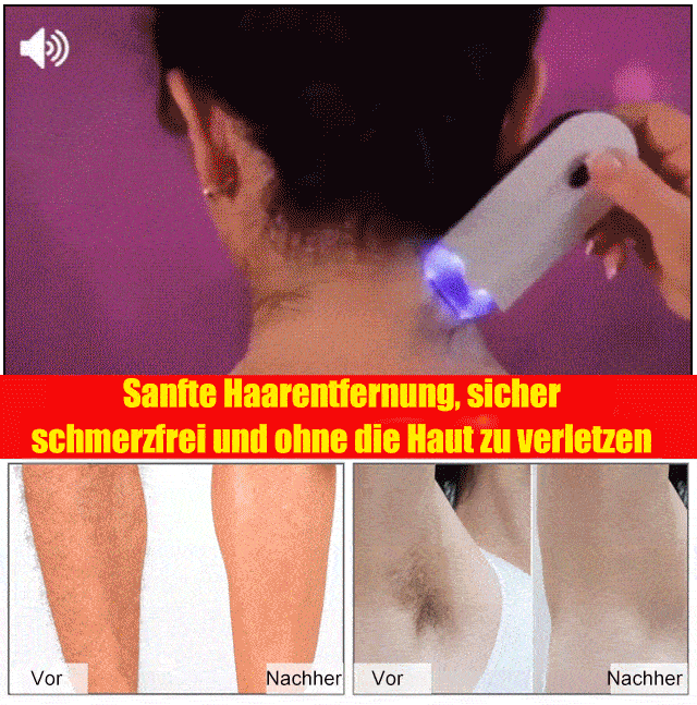 Empfohlen von der Aesthetic Society! ✨ [Unisex] Intelligentes, schmerzfreies Haarentfernungsgerät!