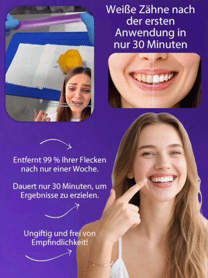 Träumen Sie von einem strahlend weißen Lächeln, ohne teure Zahnarztbesuche?【Zahnaufhellung für zu Hause】Sofortige Aufhellungsstreifen