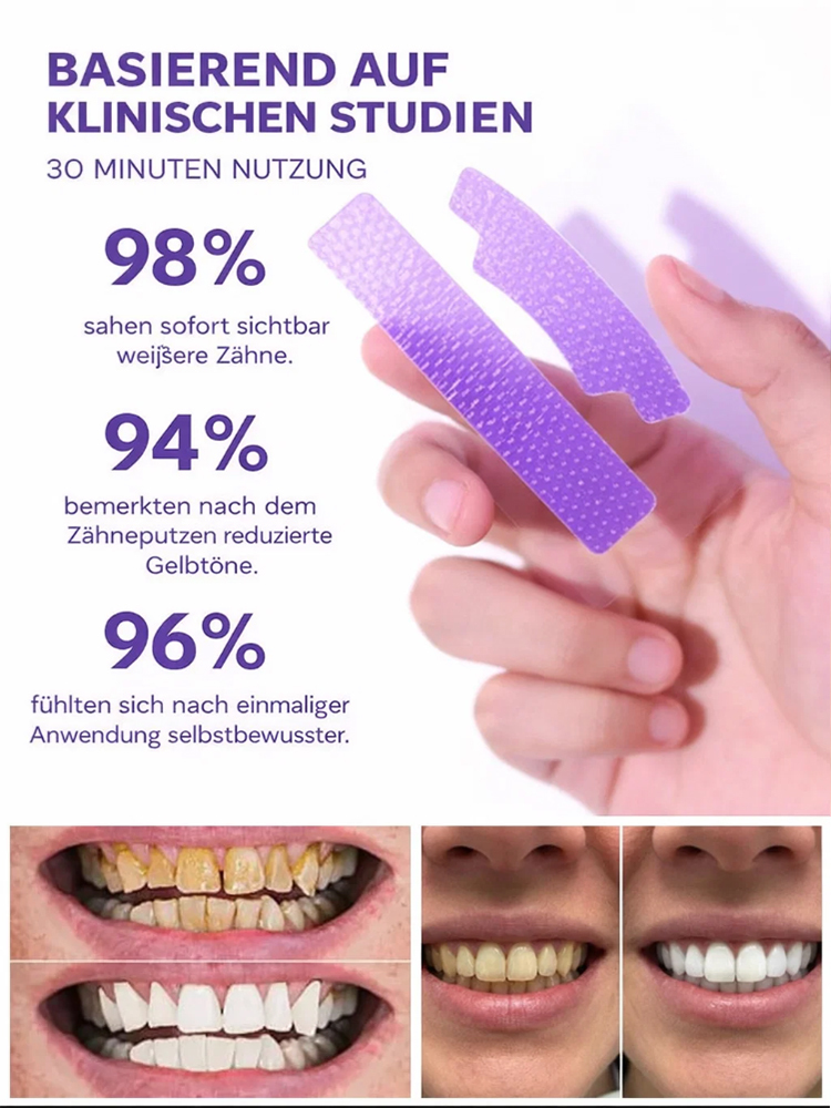 Träumen Sie von einem strahlend weißen Lächeln, ohne teure Zahnarztbesuche?【Zahnaufhellung für zu Hause】Sofortige Aufhellungsstreifen