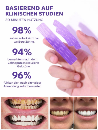 Träumen Sie von einem strahlend weißen Lächeln, ohne teure Zahnarztbesuche?【Zahnaufhellung für zu Hause】Sofortige Aufhellungsstreifen