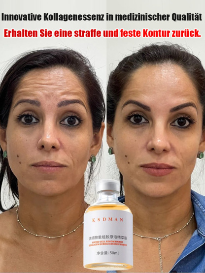 Schluss mit verschwendetem Geld für wasserbasierte Cremes, die nur auf der Hautoberfläche wirken! 🛑 Entdecken Sie die Active Collagen Essence der 3. Generation. Anders als herkömmliche Hautpflegeprodukte enthält unsere Formel 0 % Wasser – sie besteht zu
