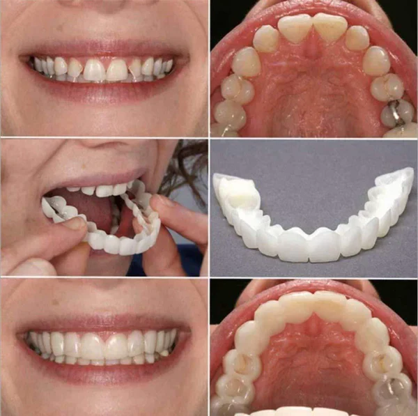 🔥 Last Day 75% OFF - Latest👨‍⚕Adjustable Snap-On Dentures