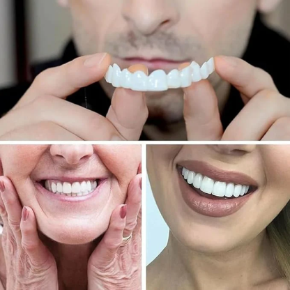 🔥 Last Day 75% OFF - Latest👨‍⚕Adjustable Snap-On Dentures