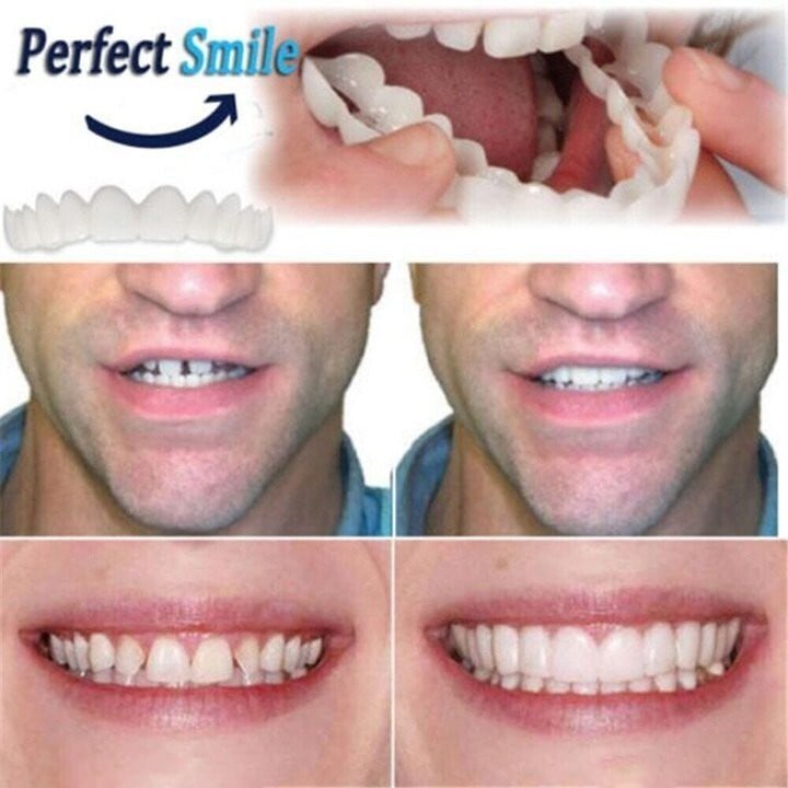 🔥 Last Day 49% OFF - Latest👨‍⚕Adjustable Snap-On Dentures