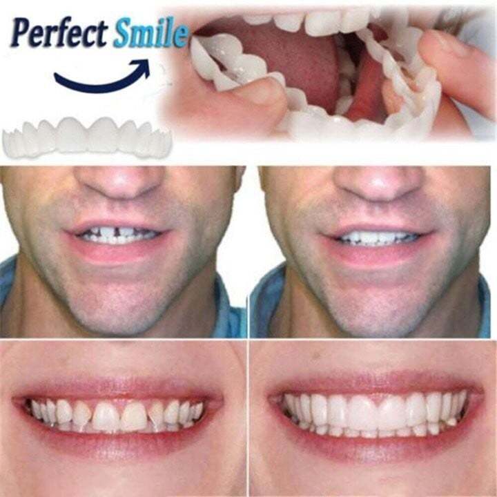 🔥 Last Day 49% OFF - Latest👨‍⚕Adjustable Snap-On Dentures
