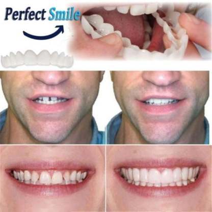 🔥 Last Day 49% OFF - Latest👨‍⚕Adjustable Snap-On Dentures
