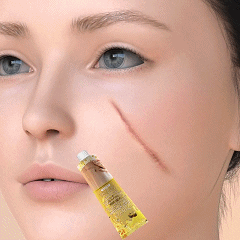 DOCTIA™ Bee Venom Medical Grade Scar Remove Advanced Gel