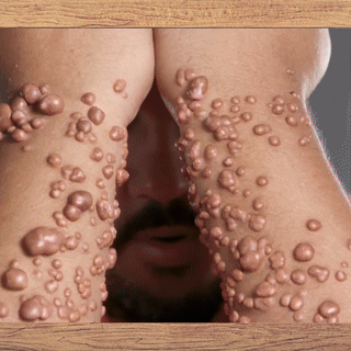 LOVILDS™ TagRecede Bee Venom Treatment Spray