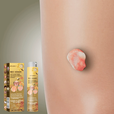 LOVILDS™ TagRecede Bee Venom Treatment Spray