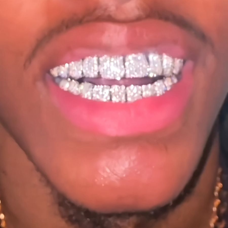 Moissanite Hip Hop Classic Grillz