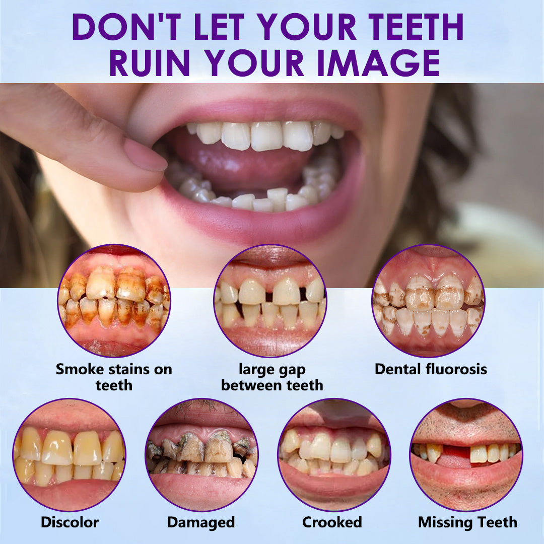 PosrystTM Silicone Reline Denture Set🦷(👩‍🔬CED Compliant Approved By Professional Dentists)