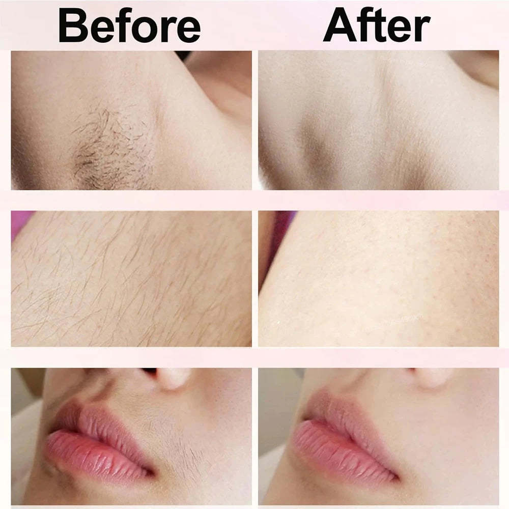 Electric Bikini Trimmer