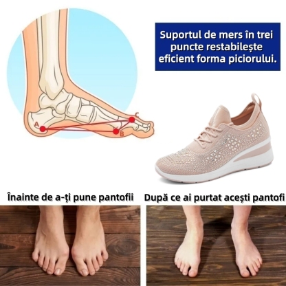 【⏰Oferta specială de astăzi: 70% reducere - Nu ratați!】 Pantofi ergonomici de vară - ✅️ Rezolvă cu ușurință problemele de durere la picioare