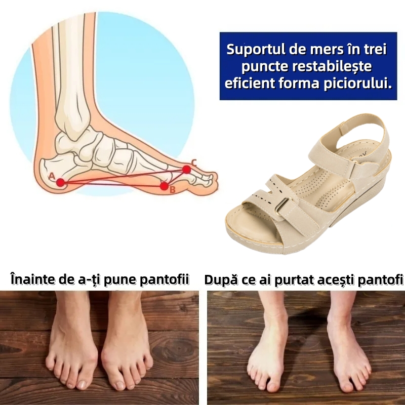 ⏰Ultima zi cu reducere de 70% - Nu rata ocazia!✅️Sandale confortabile cu suport pentru bolta plantară - Design ergonomic