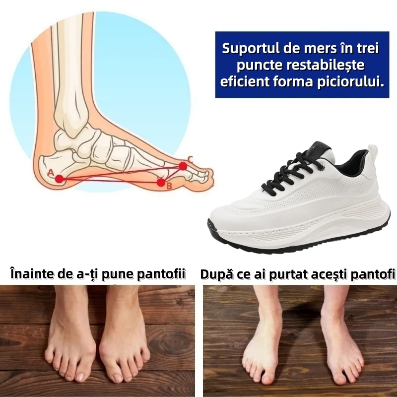 ⏰Ultima zi, reducere de 70% - nu ratați! ✅️Pantofi sport confortabili cu suport pentru bolta plantară - design ergonomic