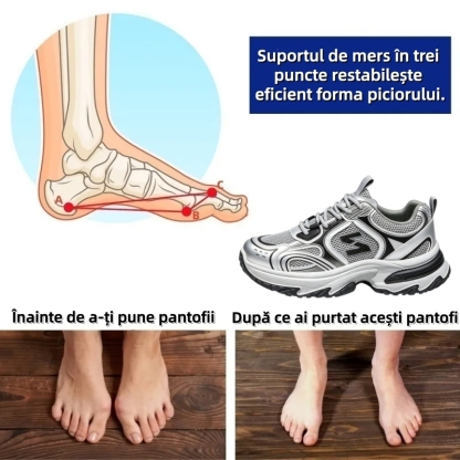 ⏰Ultima zi, reducere de 70% - nu ratați! ✅️Pantofi sport confortabili cu suport pentru bolta plantară - design ergonomic