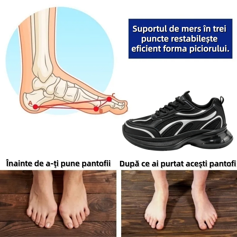⏰Ultima zi, reducere de 70% - nu ratați! ✅️Pantofi sport confortabili cu suport pentru bolta plantară - design ergonomic