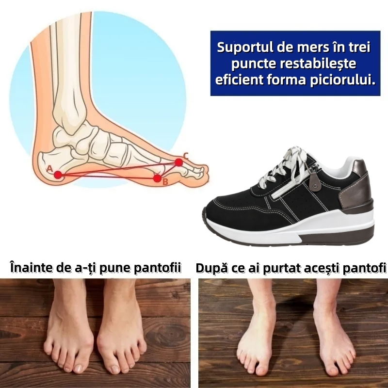 ⏰Ultima zi! Reducere 70% - Nu rata ocazia! ✅️Încălțăminte confortabilă pentru femei cu suport pentru bolta plantară - design ergonomic