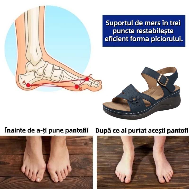 ⏰Ultima zi cu reducere de 70% - Nu rata ocazia!✅️Sandale confortabile cu suport pentru bolta plantară - Design ergonomic