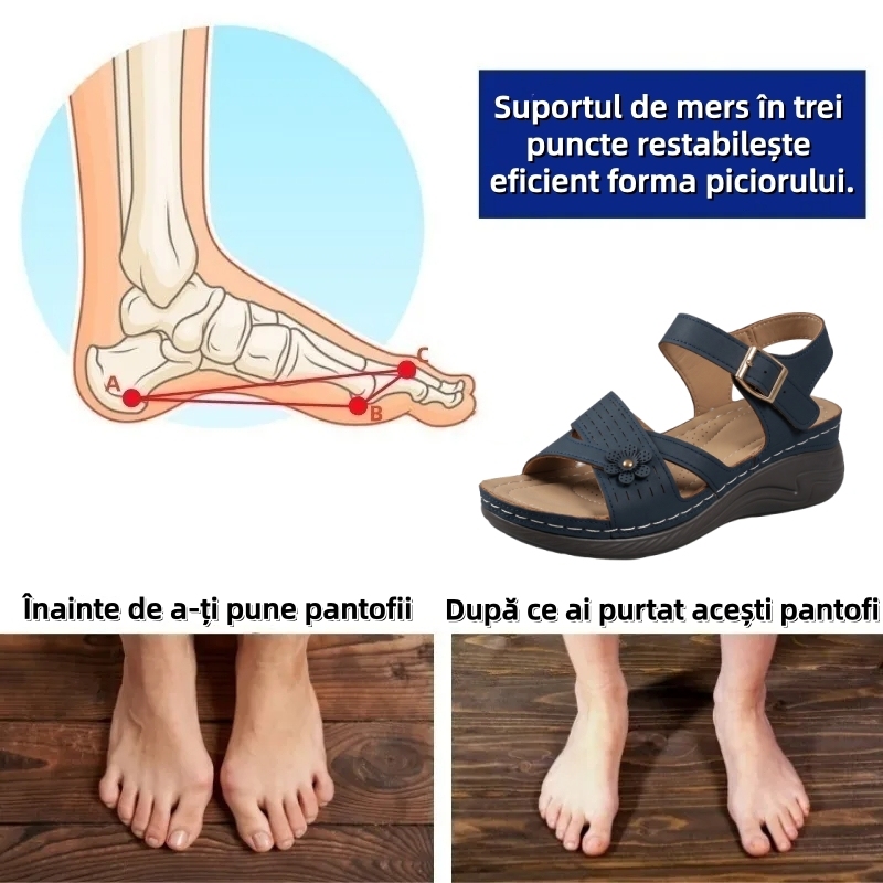 ⏰Ultima zi cu reducere de 70% - Nu rata ocazia!✅️Sandale confortabile cu suport pentru bolta plantară - Design ergonomic