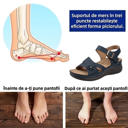 ⏰Ultima zi cu reducere de 70% - Nu rata ocazia!✅️Sandale confortabile cu suport pentru bolta plantară - Design ergonomic