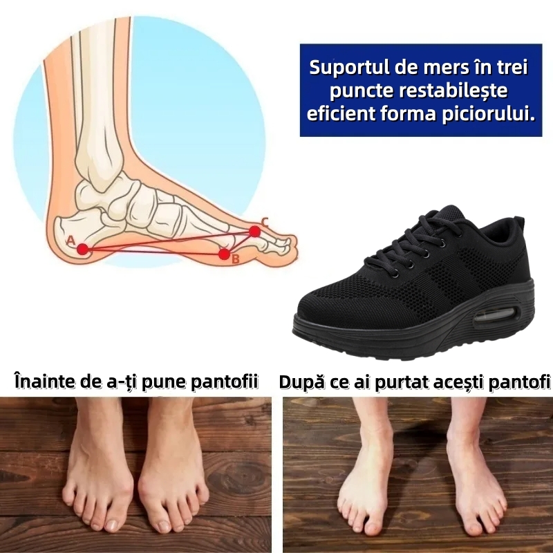 ⏰Ultima zi! Reducere 70% - Nu rata ocazia! ✅️Încălțăminte confortabilă pentru femei cu suport pentru bolta plantară - design ergonomic