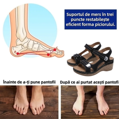 ⏰Ultima zi cu reducere de 70% - Nu rata ocazia!✅️Sandale confortabile cu suport pentru bolta plantară - Design ergonomic