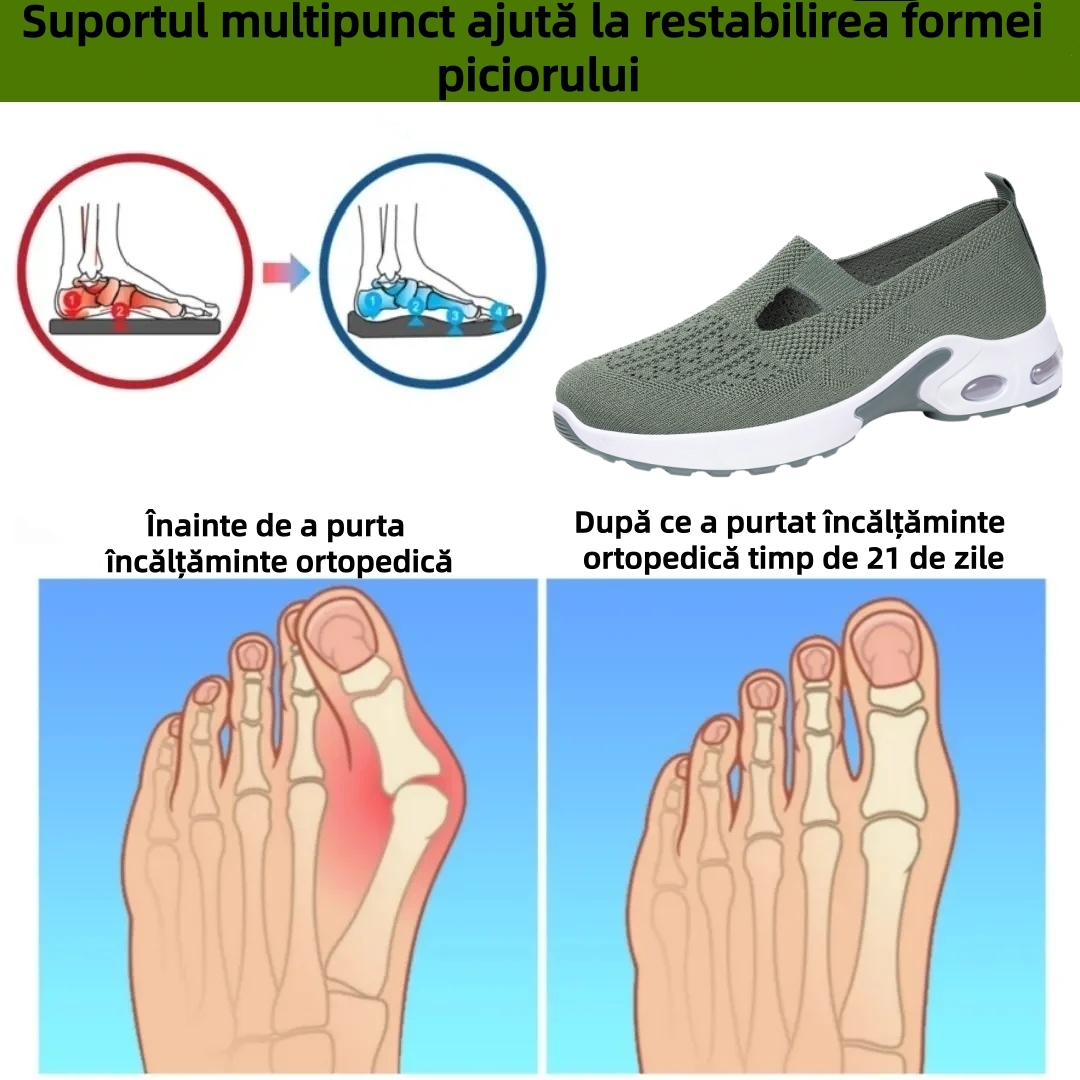 【⏰Oferta specială de astăzi: 70% reducere - Nu ratați!】 Pantofi ergonomici de vară - ✅️ Rezolvă cu ușurință problemele de durere la picioare