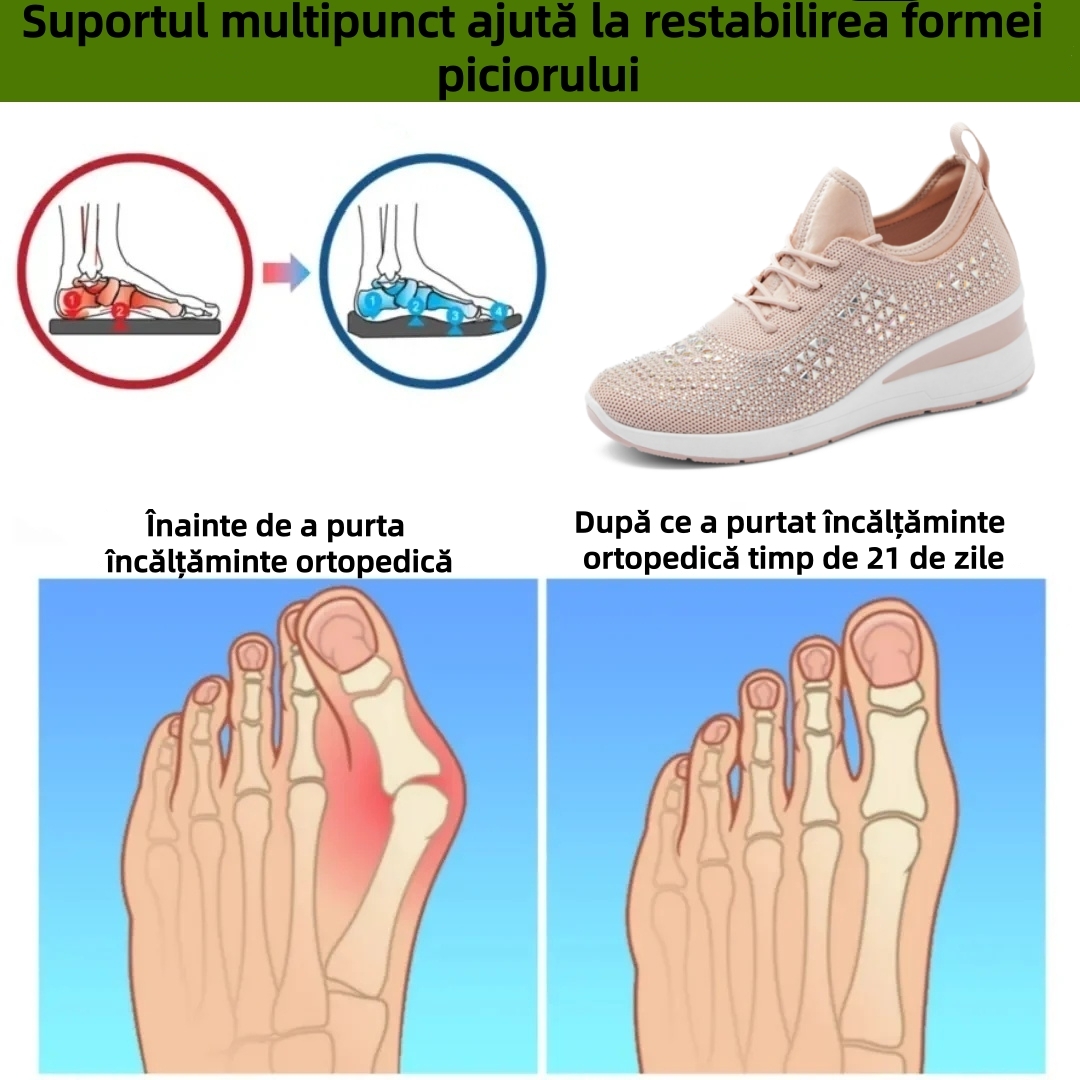 【⏰Oferta specială de astăzi: 70% reducere - Nu ratați!】 Pantofi ergonomici de vară - ✅️ Rezolvă cu ușurință problemele de durere la picioare