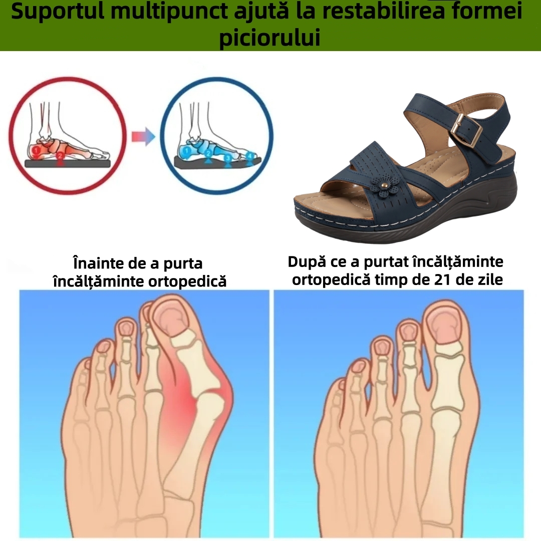 ⏰Ultima zi cu reducere de 70% - Nu rata ocazia!✅️Sandale confortabile cu suport pentru bolta plantară - Design ergonomic