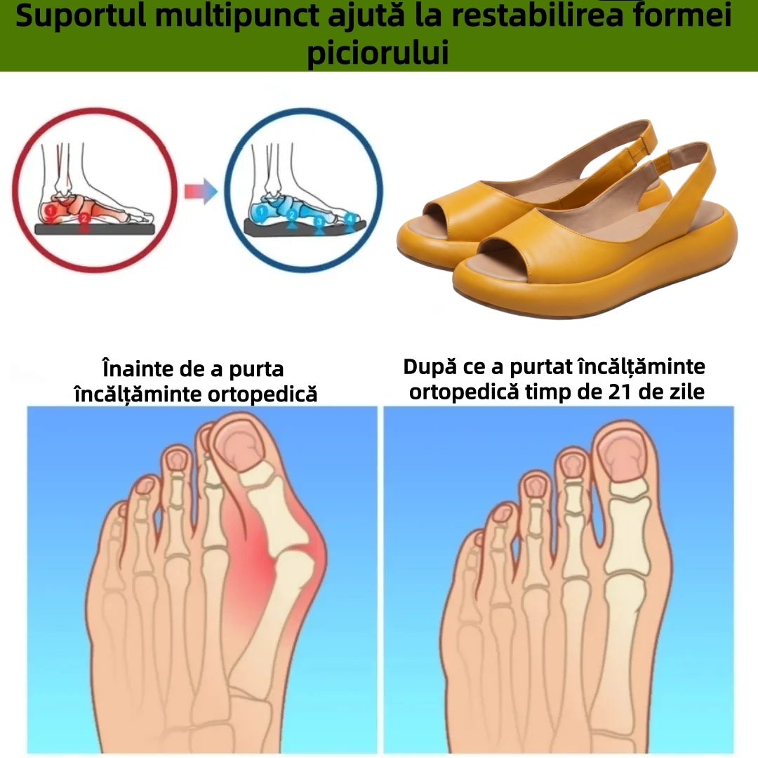 ⏰Ultima zi cu reducere de 70% - Nu rata ocazia!✅️Sandale confortabile cu suport pentru bolta plantară - Design ergonomic