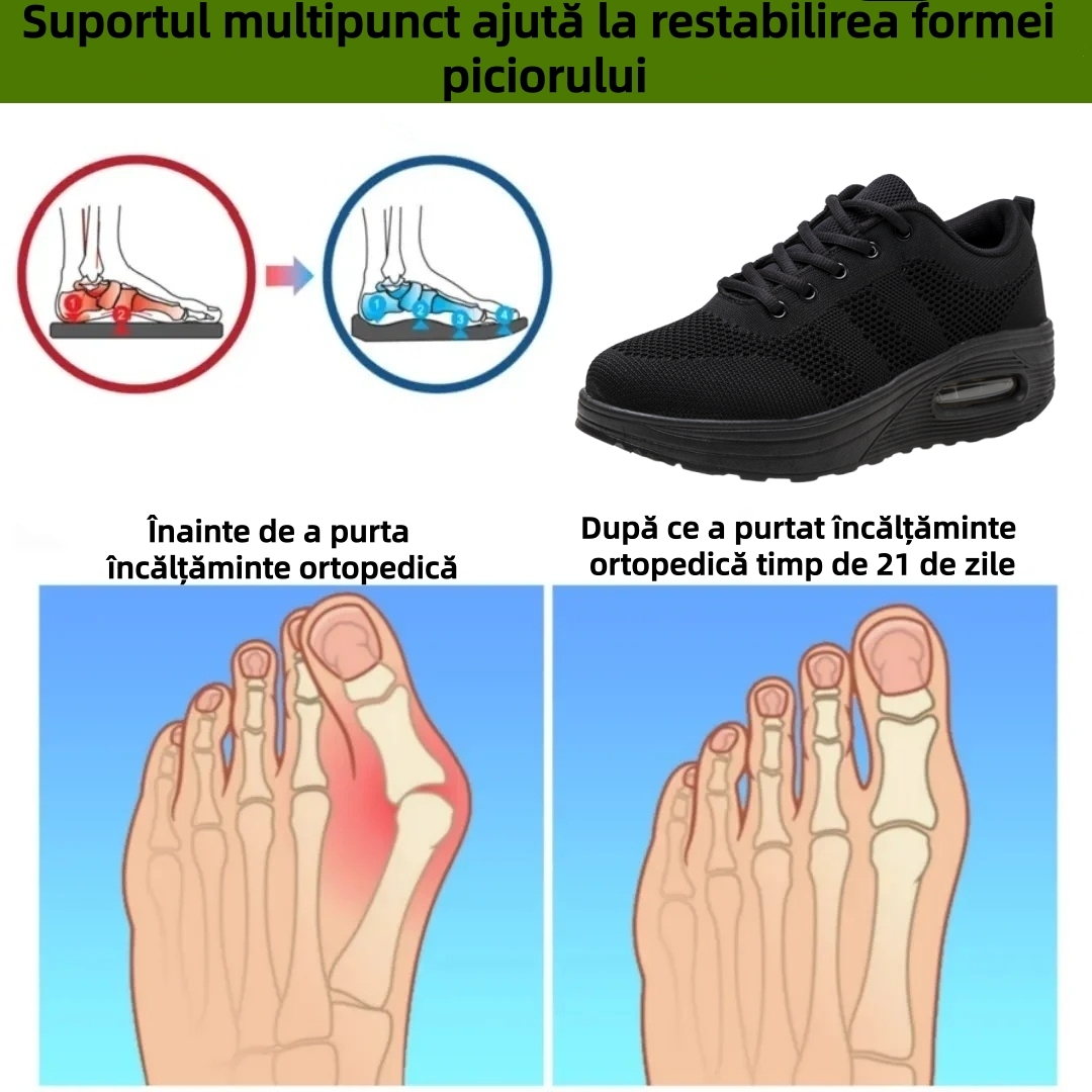 ⏰Ultima zi! Reducere 70% - Nu rata ocazia! ✅️Încălțăminte confortabilă pentru femei cu suport pentru bolta plantară - design ergonomic